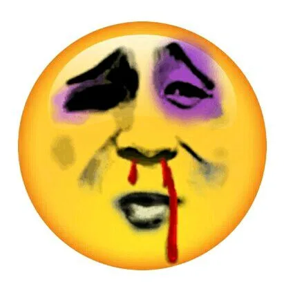 被打了