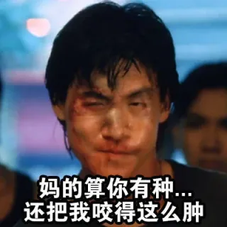 妈的算你有种....还把我咬得这么肿