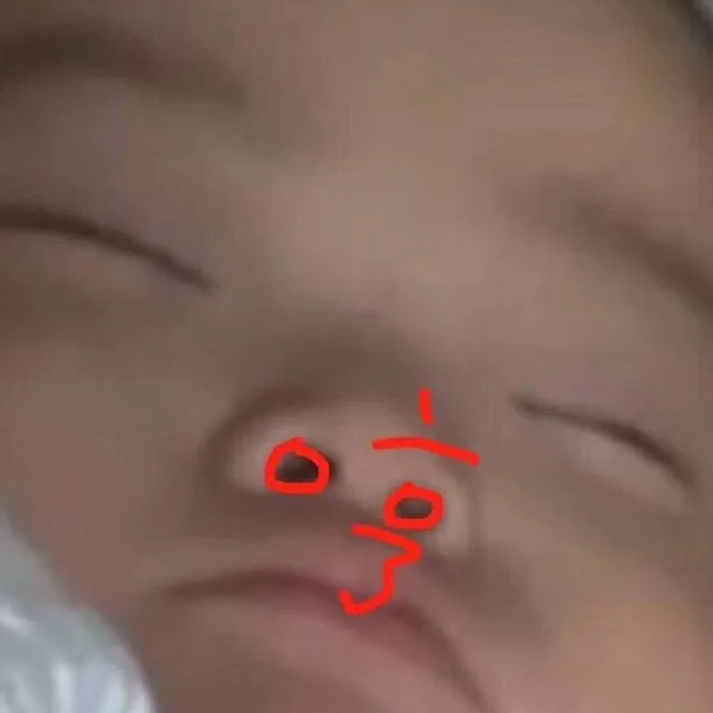 哼（鼻孔）
