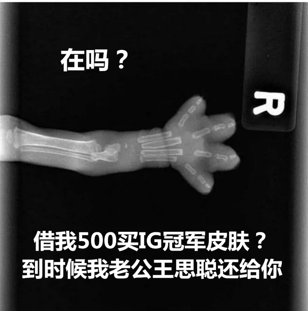 在吗借我500买IG冠军皮肤到时候我老公王思聪还给你