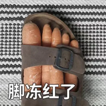 脚冻红了（脚冻红了）